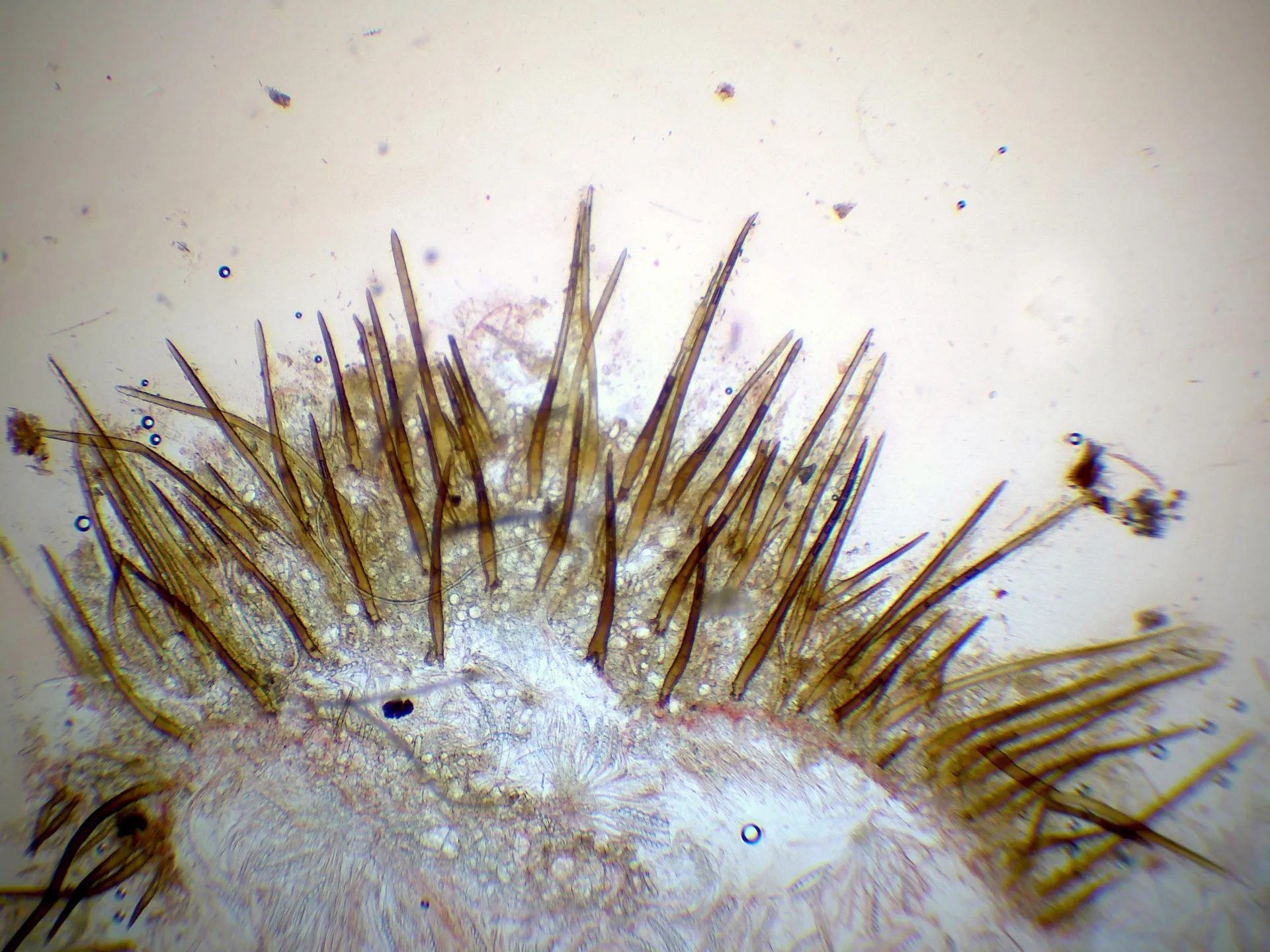 Microscopía de Scutellinia umbrorum - 11 - Pelos x 40-001